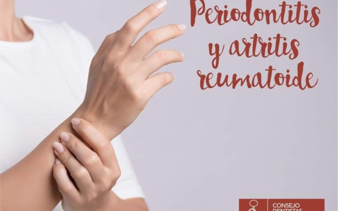 artritis reumatoide y periodontitis